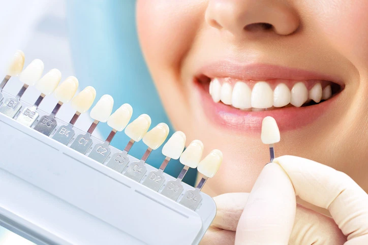 Cosmetic Dentists in Dubai: What to Look for and Why
