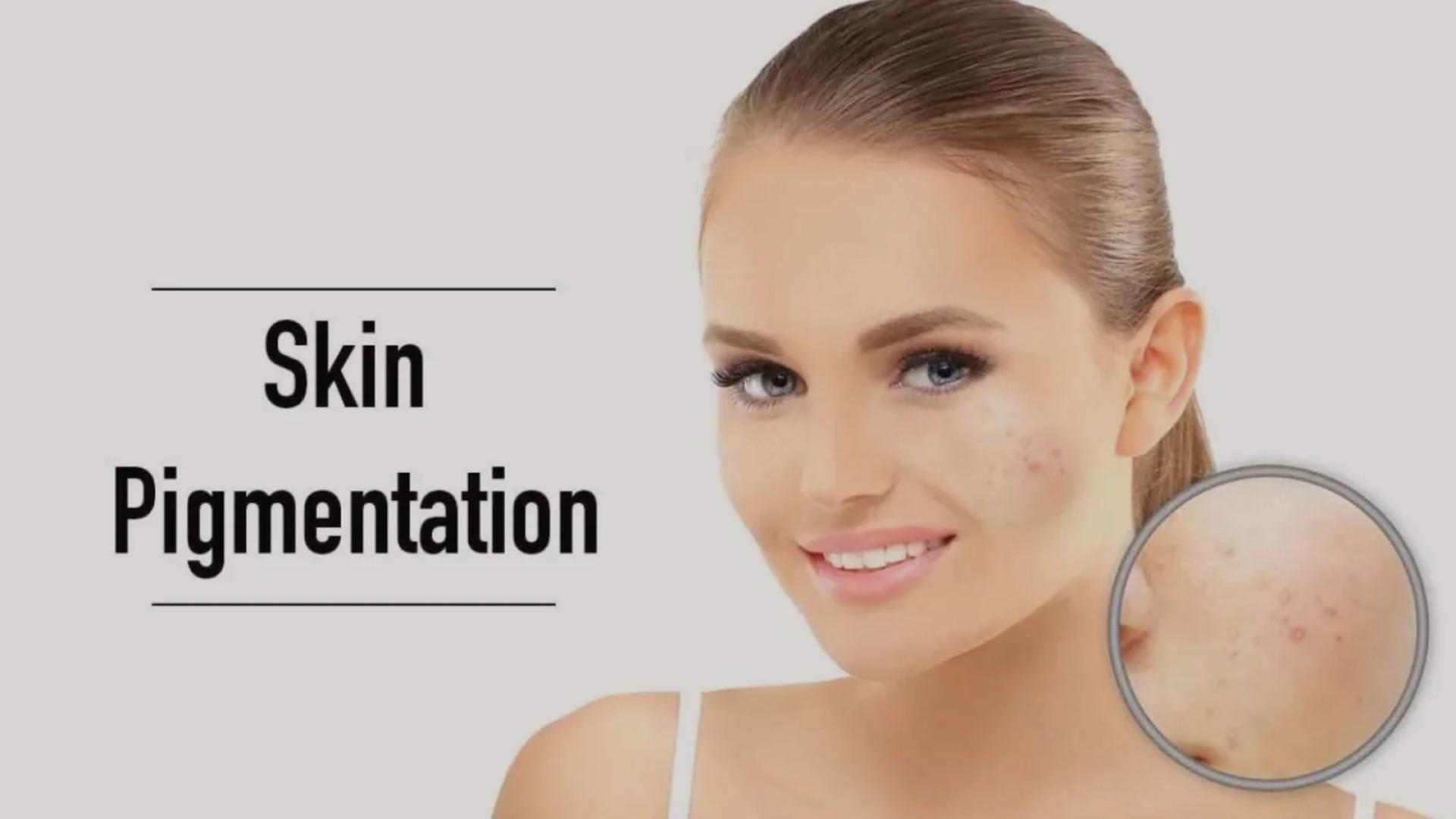 Top Treatments for Skin Pigmentation Removal in Pune: What You Should Know