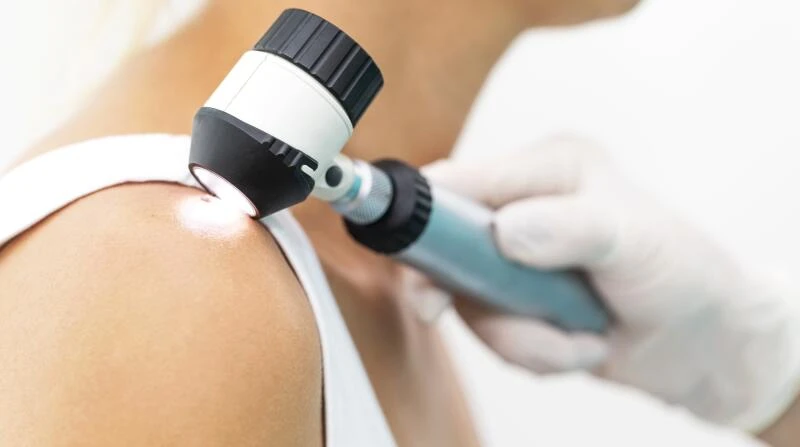 How Often Should You See Dermatologist for Skin Cancer Screening?