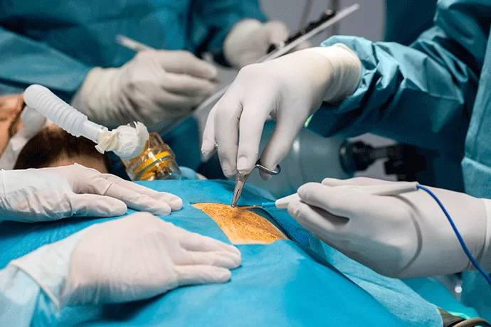 From Diagnosis to Recovery: What to Expect from a General Surgeon in Bharuch