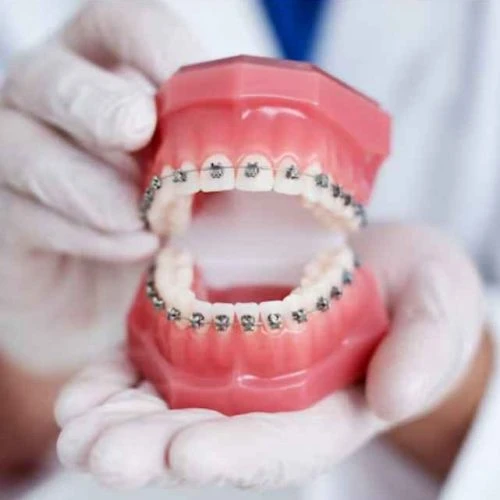 Dental Implants Treatment Dubai | Dental Implantology Dubai