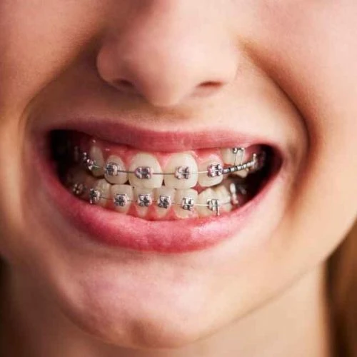 best dentist in dubai for root canal