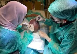 Hair Transplant in Dubai: Cost, Clinics, and Results Explained