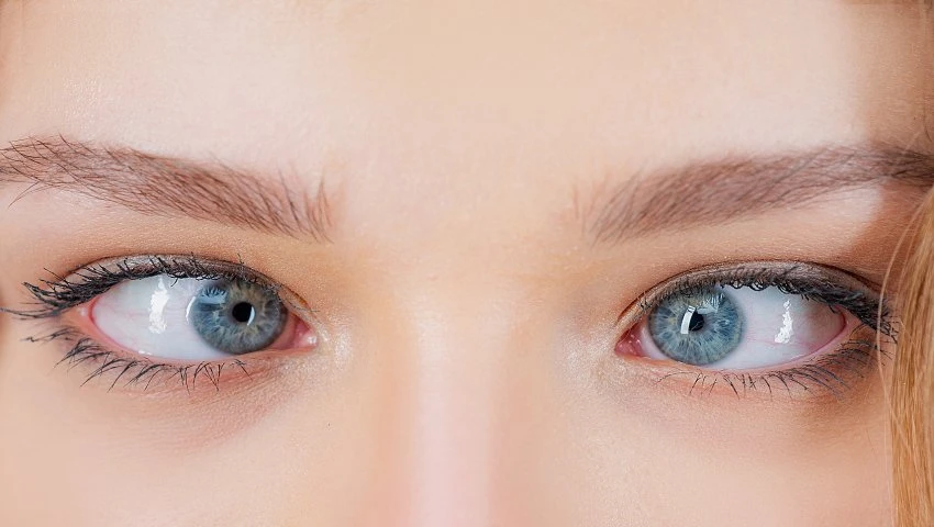 Correcting Squint: Understanding Strabismus and Treatment Option