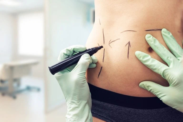 Is Abdominoplasty Dubai Safe? Understanding the Benefits