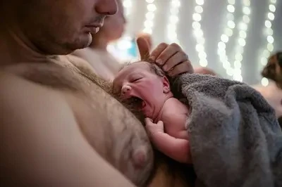 Circumcision in Dallas: A Comprehensive Guide for Parents