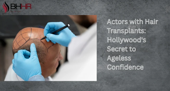 Actors with Hair Transplants: Hollywood's Secret to Ageless Confidence