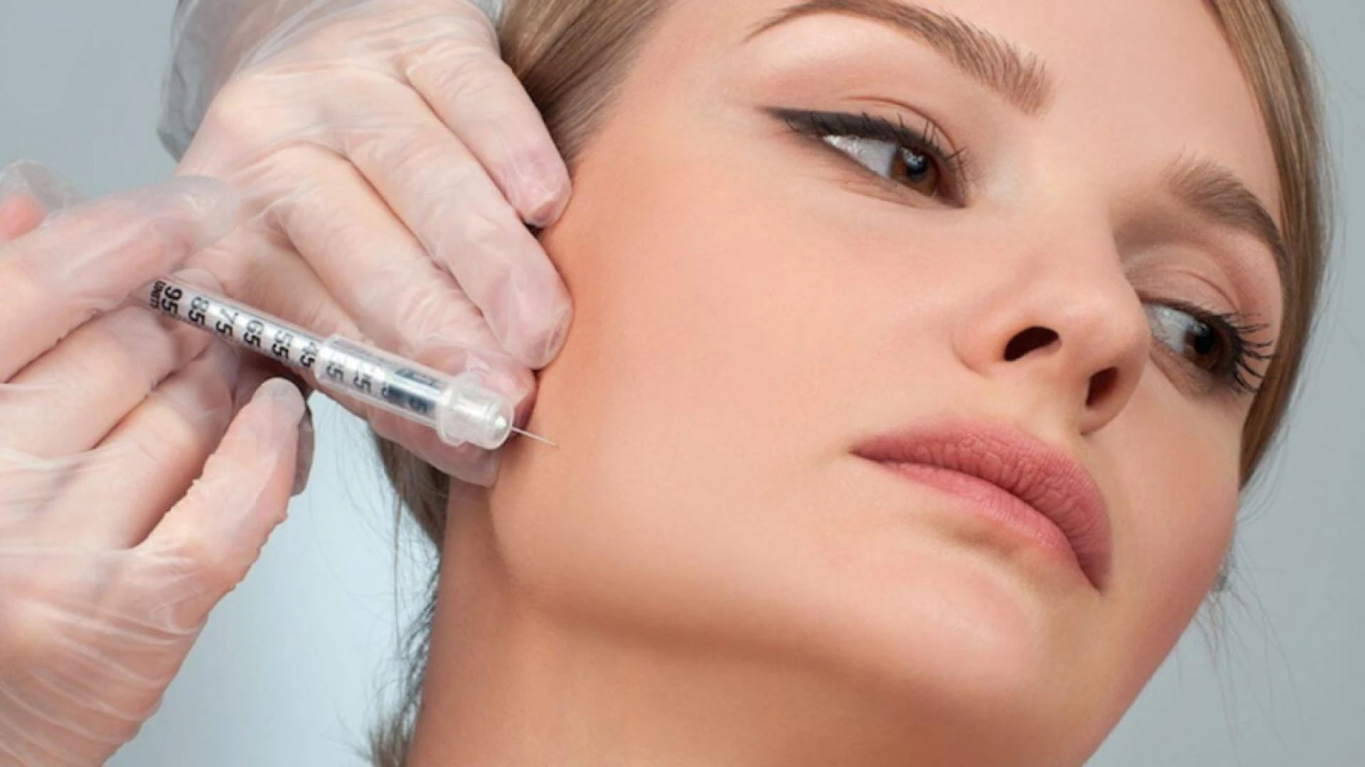 Chin Filler: A Non-Surgical Solution for Facial Harmony