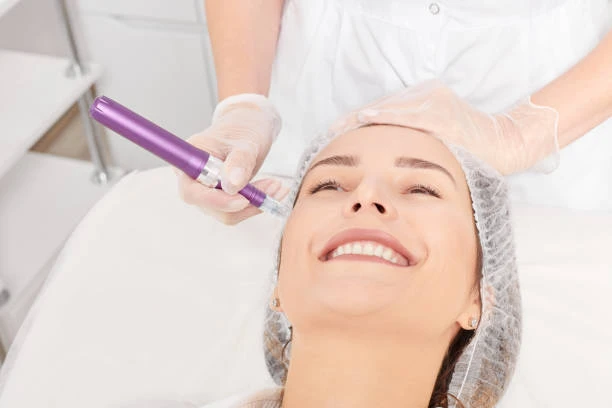  7 Amazing Results You’ll See with Derma Pen in 2025
