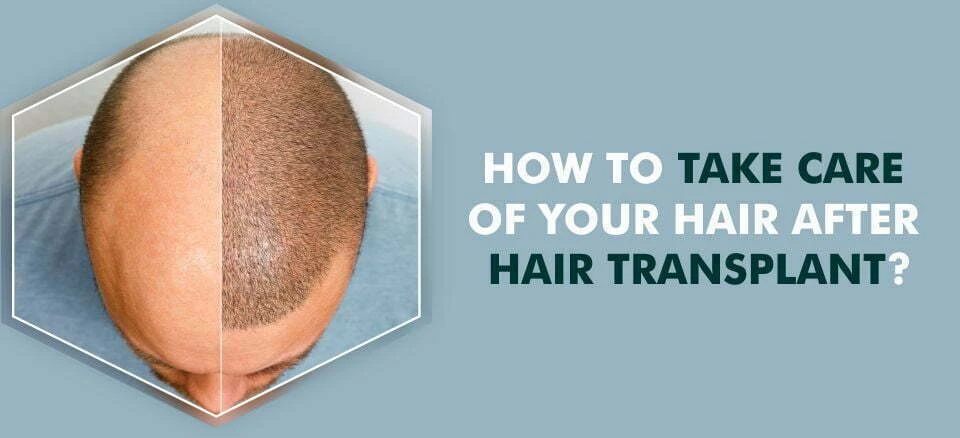 How to Care for Your Hair After a Hair Transplant in Philadelphia