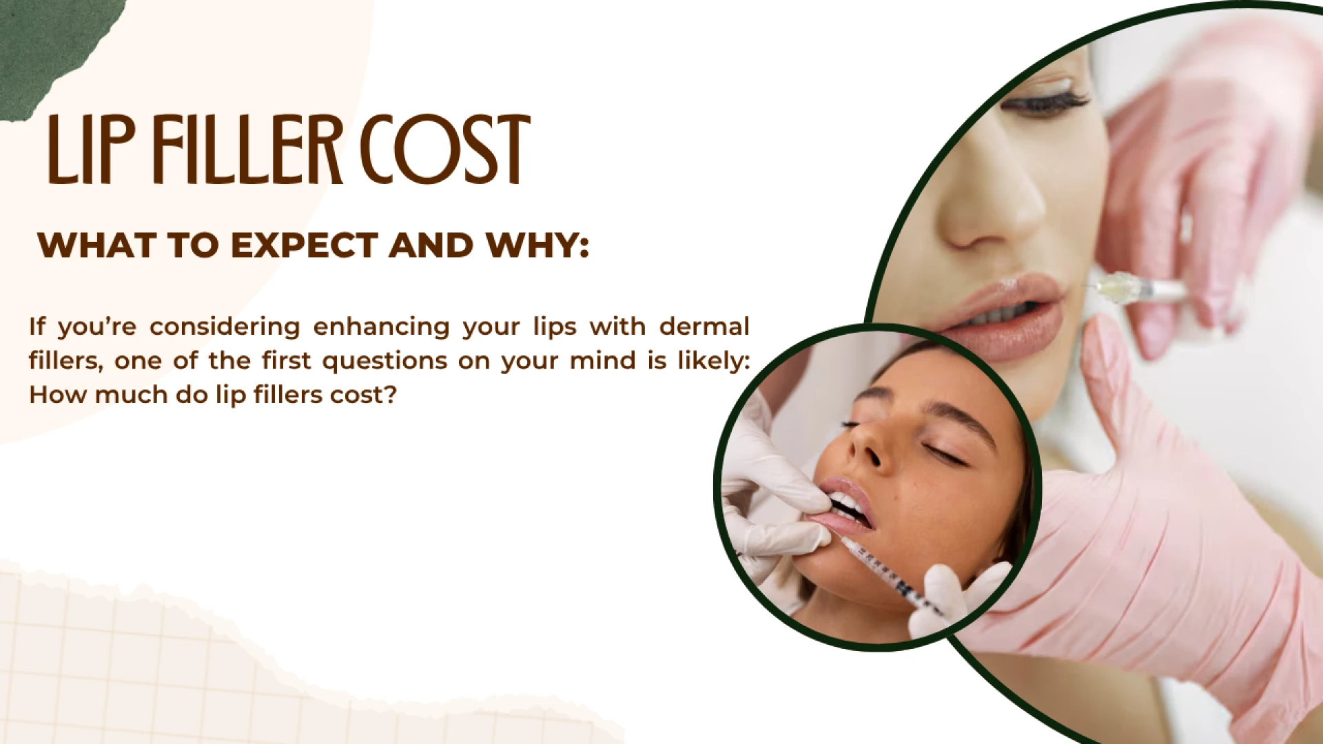 Lip Fillers Cost: What to Expect and Why New U Med Spa Orlando Is Worth Every Penny