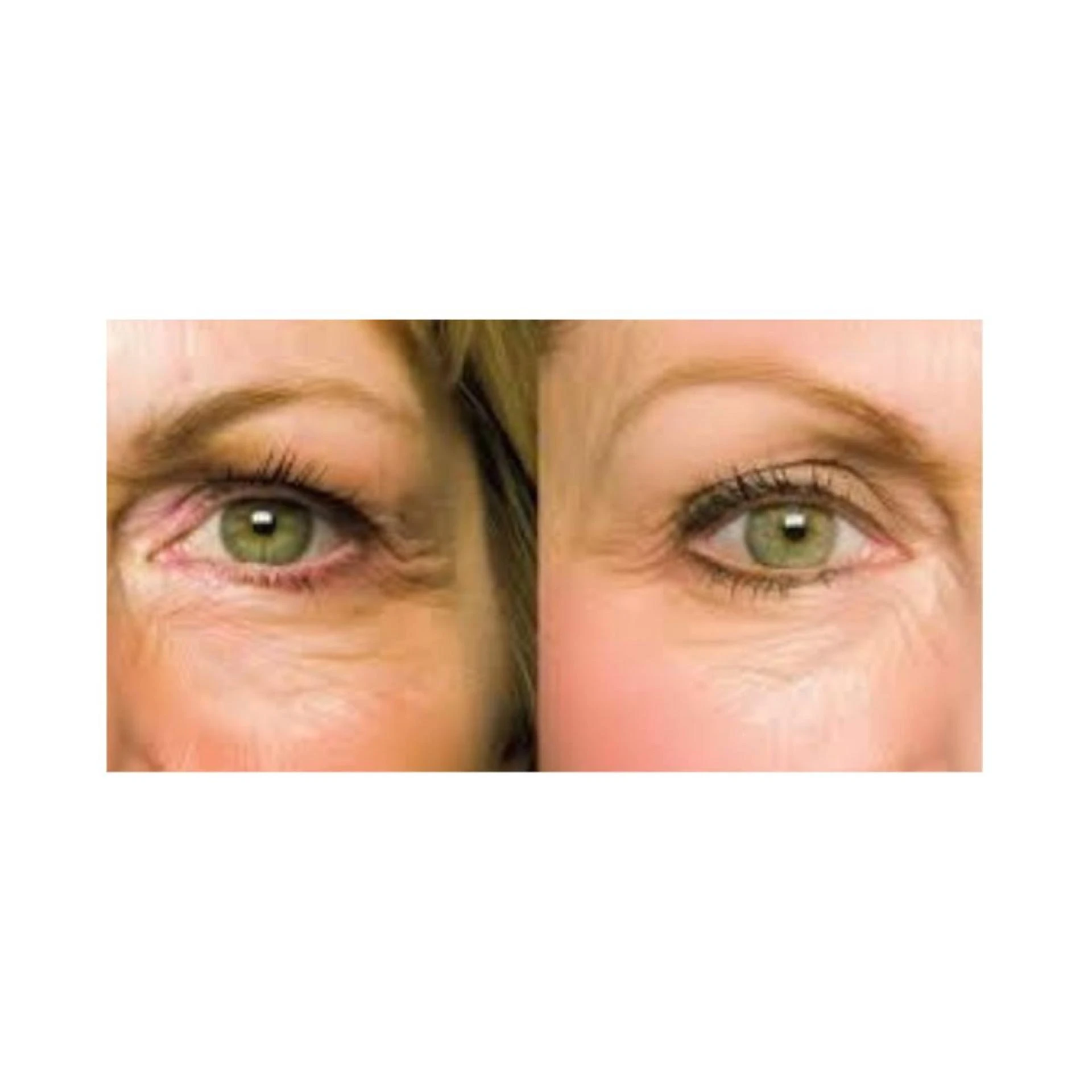 From Wrinkle Reduction to Hair Strength: The Power of Verisol Collagen Peptides