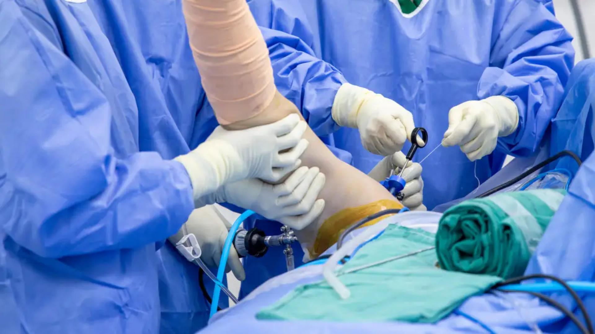 How Arthroscopic Surgery Works: A Comprehensive Guide