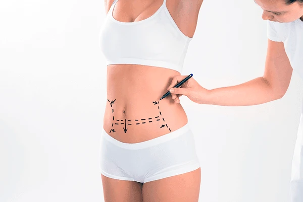 Top 6 Non-Surgical Treatments for Liposuction Hard Spots