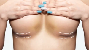 Everything You Need to Know About Breast Enlargement in Dubai