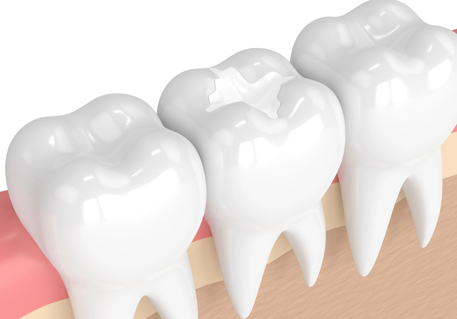 Restore Your Smile with Confidence: A Guide to Restorative Dentistry