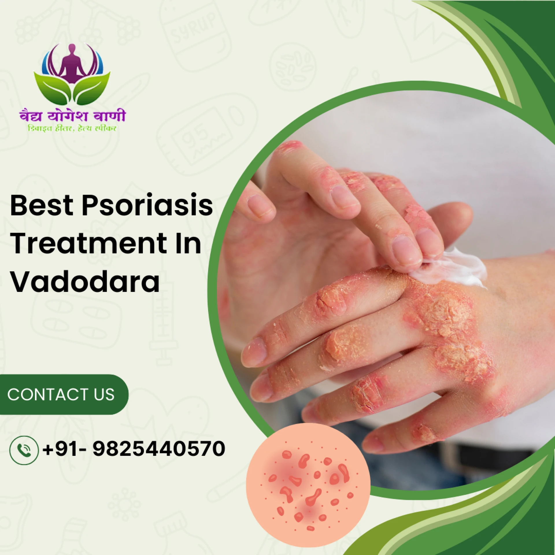 Who are the top dermatologists for psoriasis in Vadodara