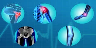 What Are the Most Common Orthopedic Conditions?