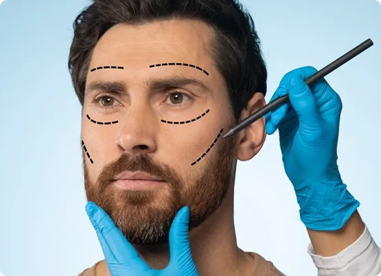 Unlock Youth: 10 Reasons to Choose Facelift Surgery in Lahore