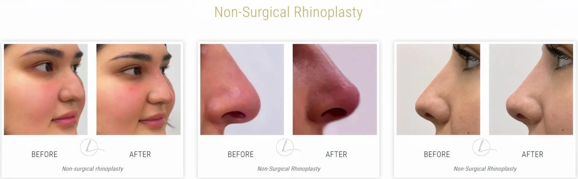 The Future of Slimming Down: How Telemedicine Is Transforming Weight Loss Care