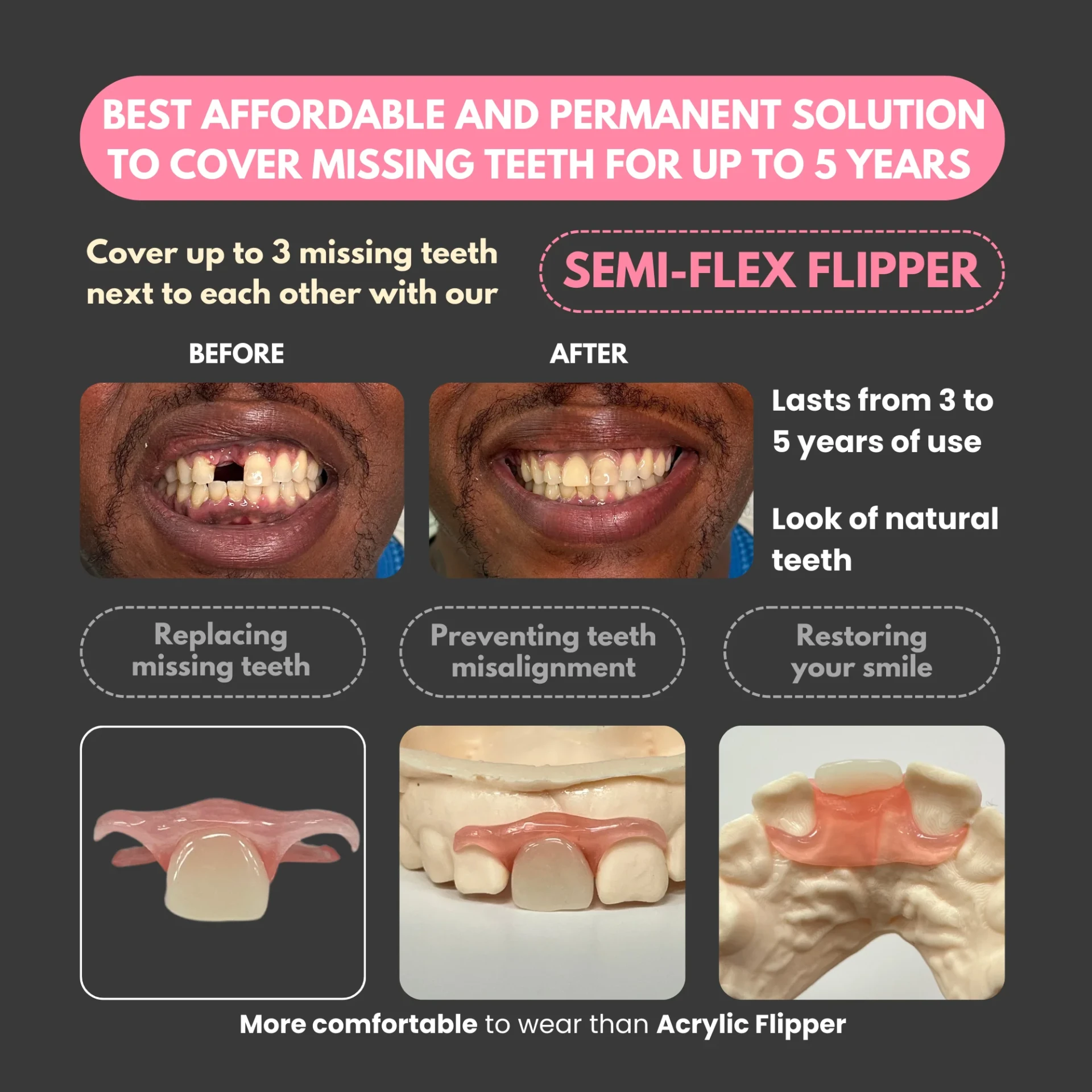 Smile Solutions on a Budget: Exploring Affordable Dental Alternatives