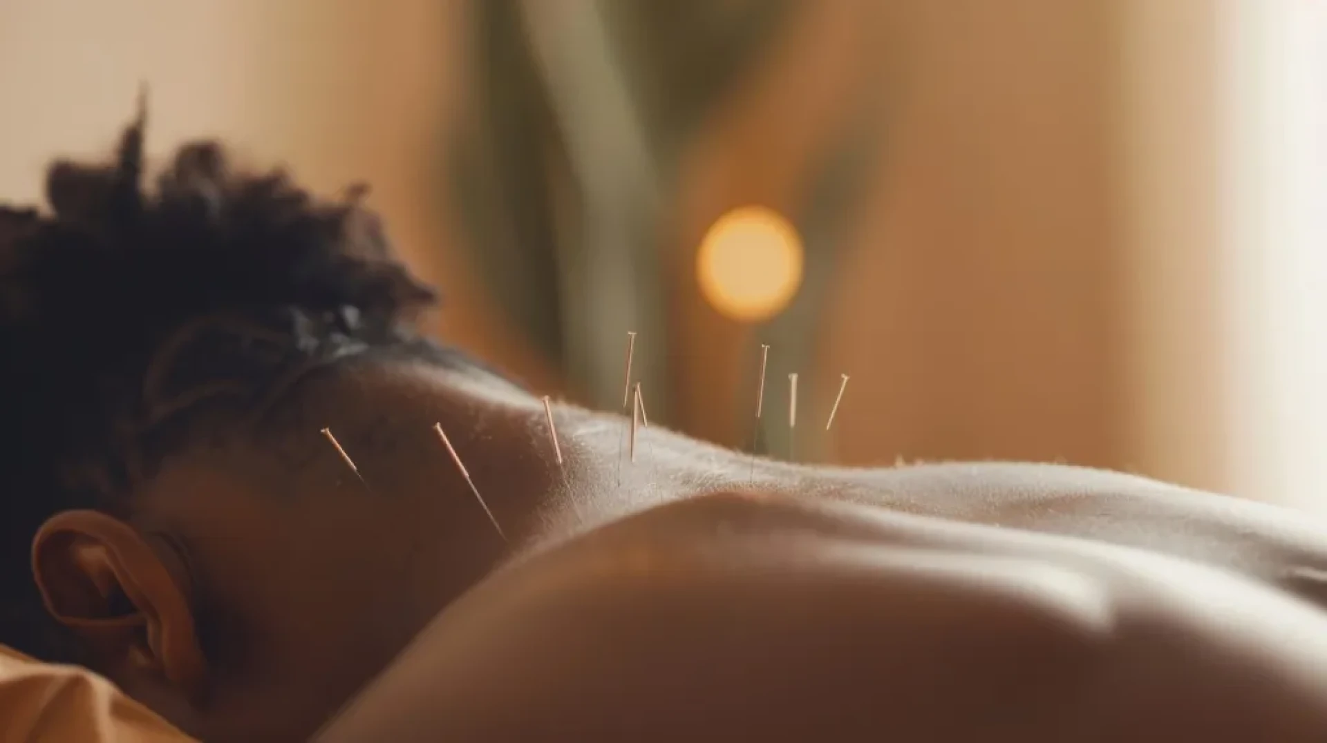What to Expect from Your First Acupuncture Session in Austin