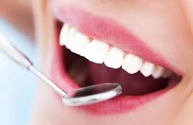 Teeth Cleaning in Silicon Oasis Dubai