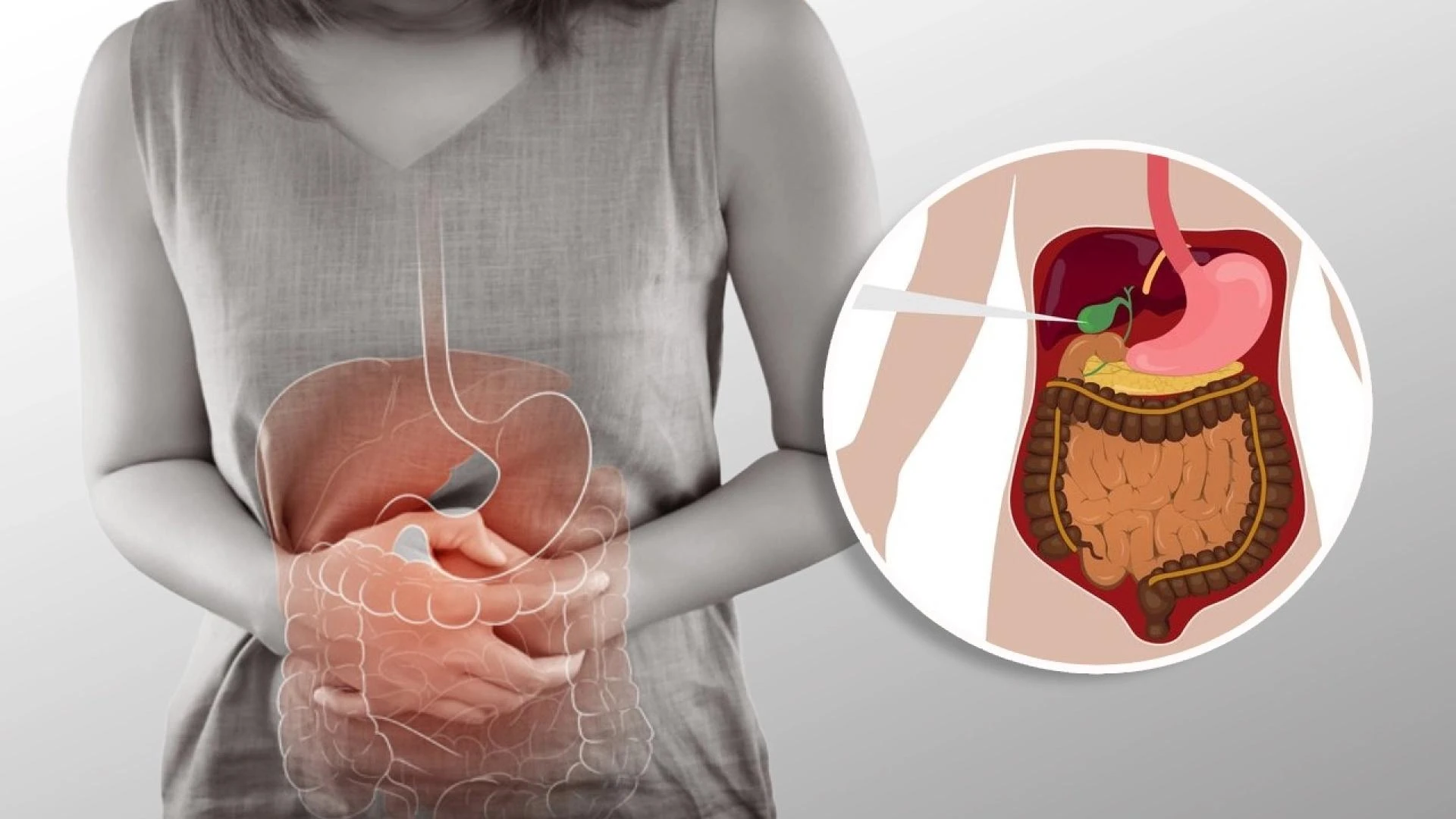 Gallbladder Stone Treatment in Delhi: Safe, Simple, and Affordable
