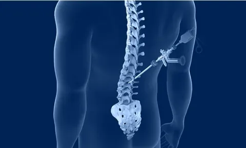 Minimally Invasive Spine Surgery: A Patient’s Guide