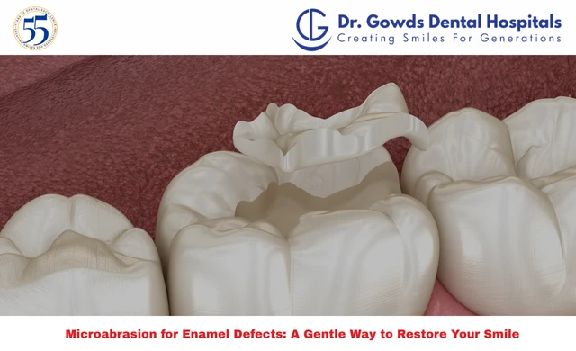 Restore Your Smile with Microabrasion for Enamel Defects