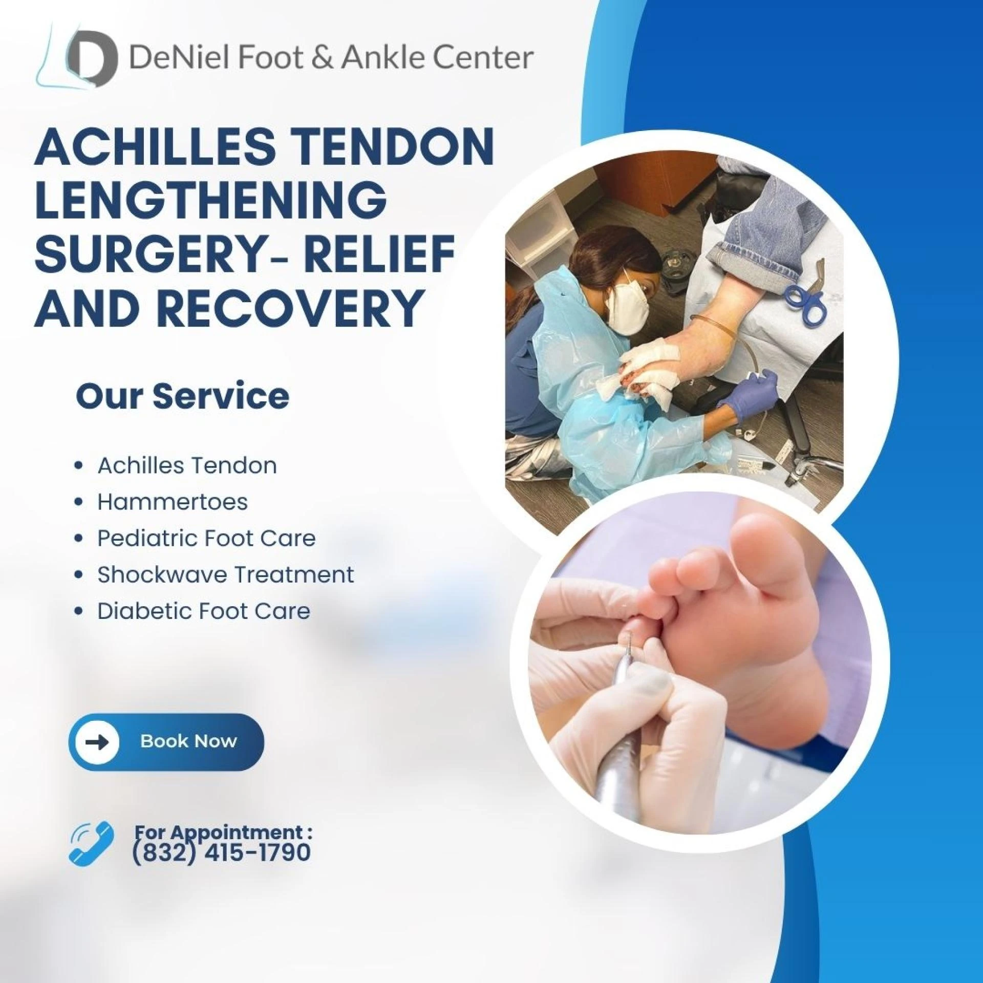 Achilles Tendon Lengthening Surgery- Relief and Recovery