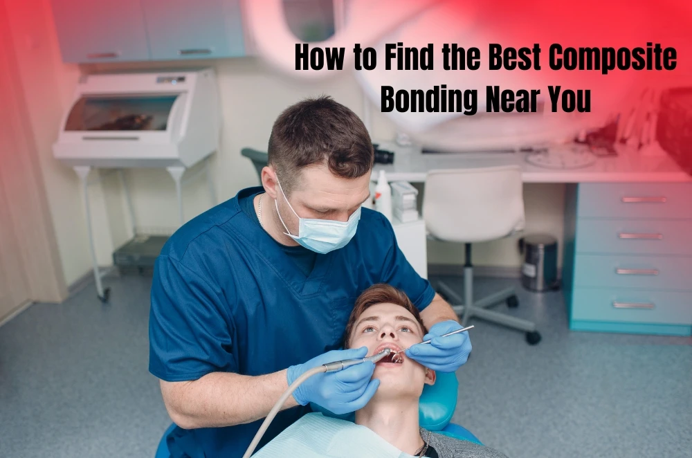 How to Find the Best Composite Bonding Near You