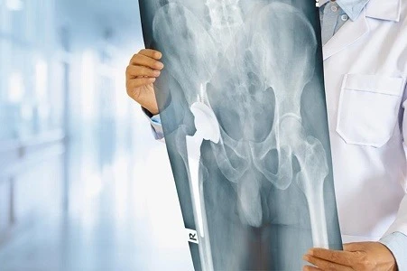 Nagpur Walks Again: Real Stories from Patients Who Beat Knee Pain with Dr. Utsav Sir