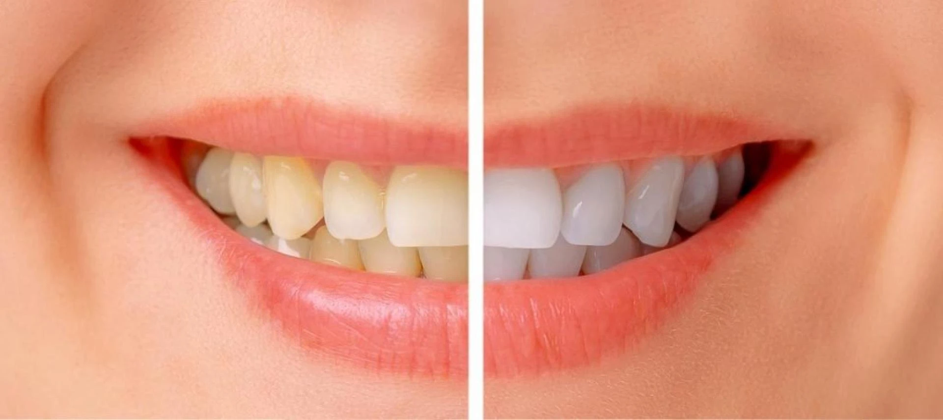 Smile Brighter: A Healthier Mouth Starts With You