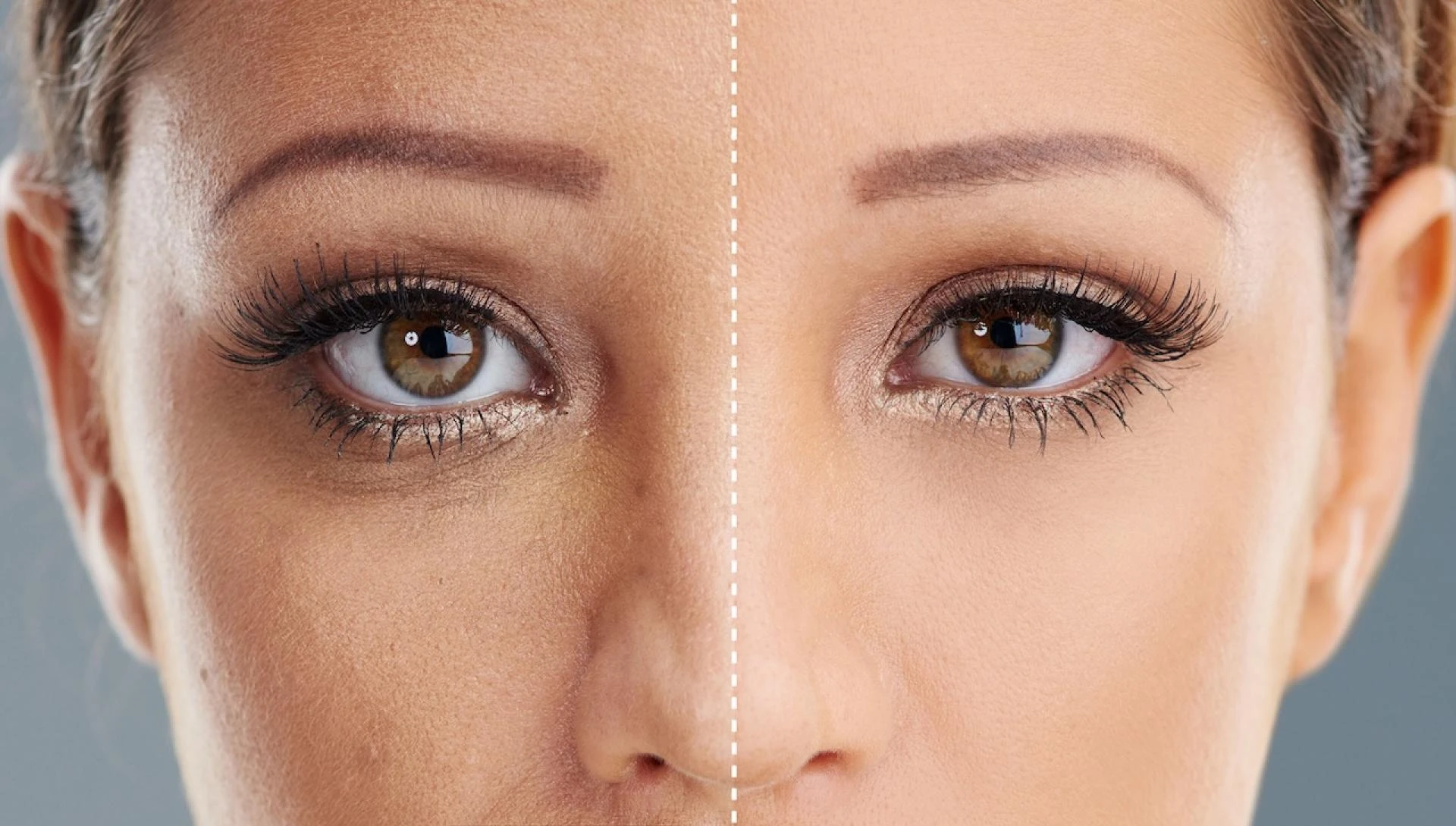 Glow Renewed: Exploring Anti-Aging and Sunspot Solutions with a Dermatologist in Brooklyn