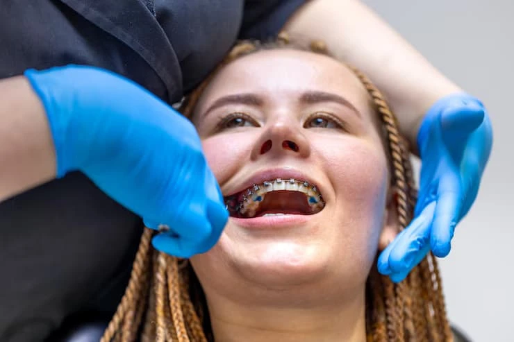 Choosing an Orthodontist That Matches Your LA Lifestyle