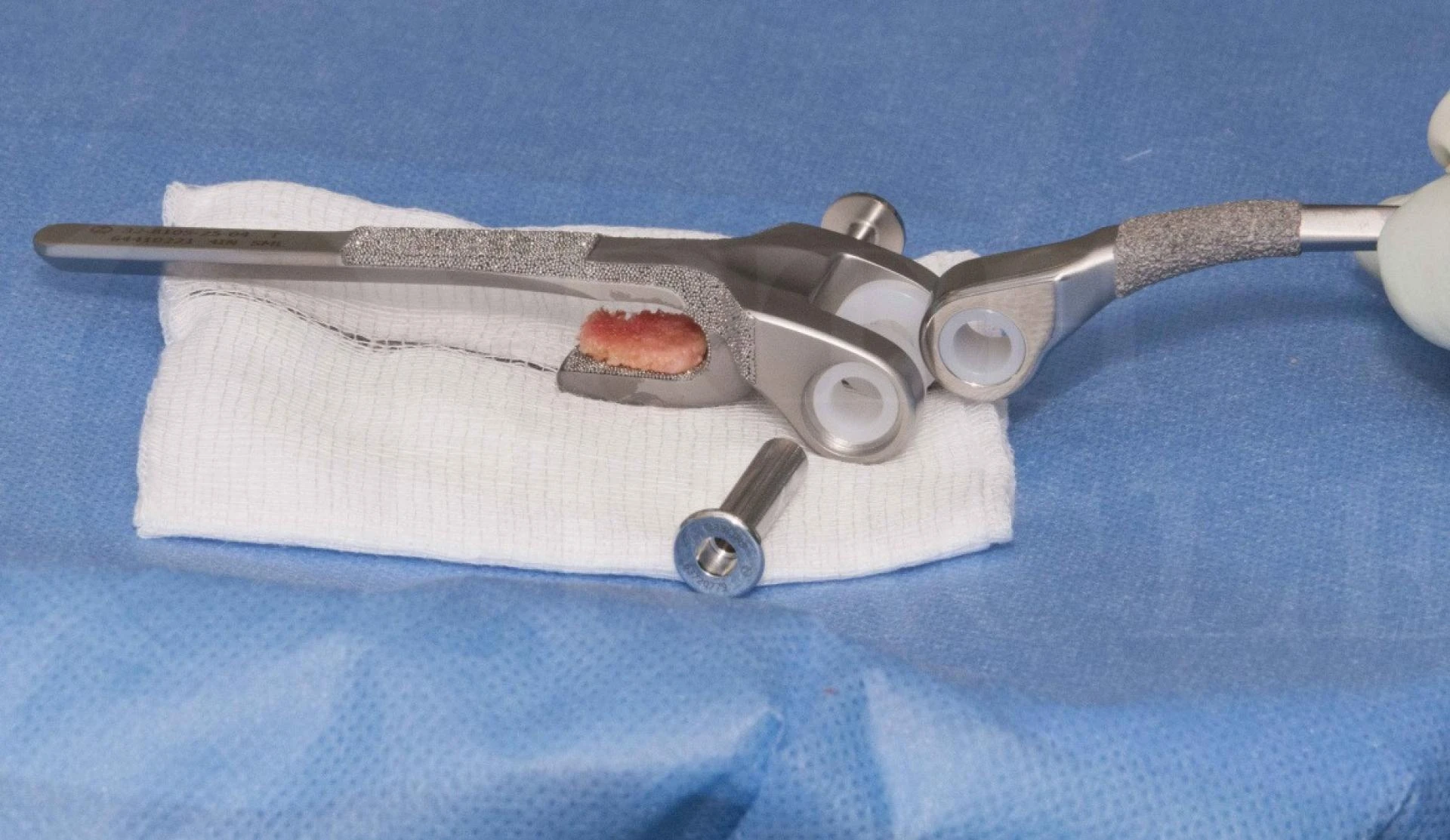 Modern Solutions for Elbow Joint Issues: Total Elbow Replacement Surgery in Delhi