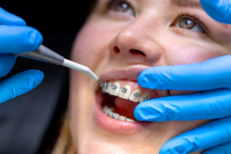 The Importance of Participating in an Orthodontist Course