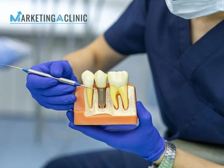 Dental Implant Marketing Strategies to Grow Your Practice in 2025