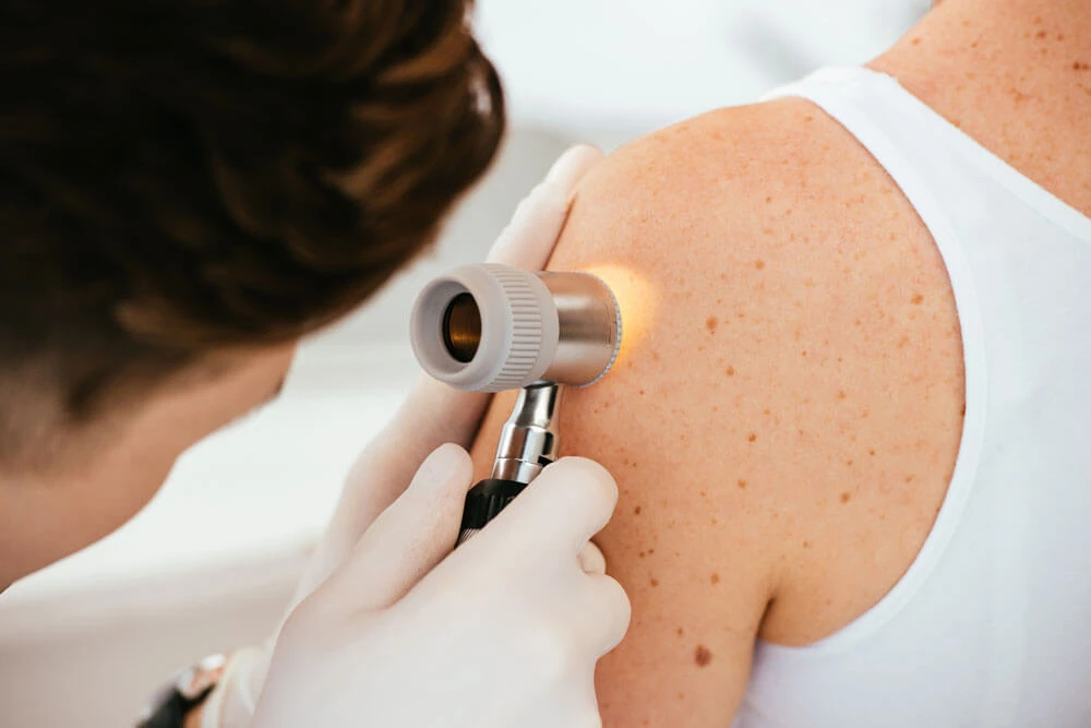 Skin Clinic in Adyar - The Skin Cliniq