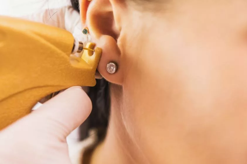Medical Piercing Services: Safe, Sterile, and Professional Body Piercing by Healthcare Providers