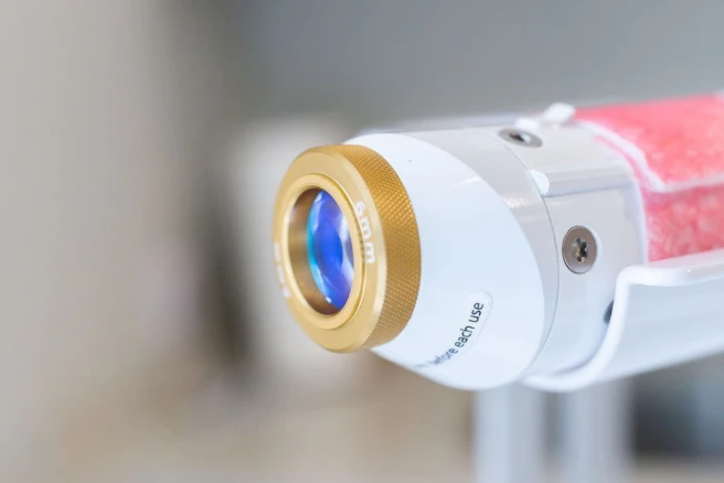 Top Hyperpigmentation Treatments in Tampa That Actually Work