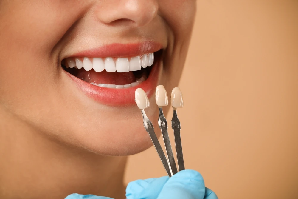 How Dental Implants Support Long Term Oral Health in Miami Florida
