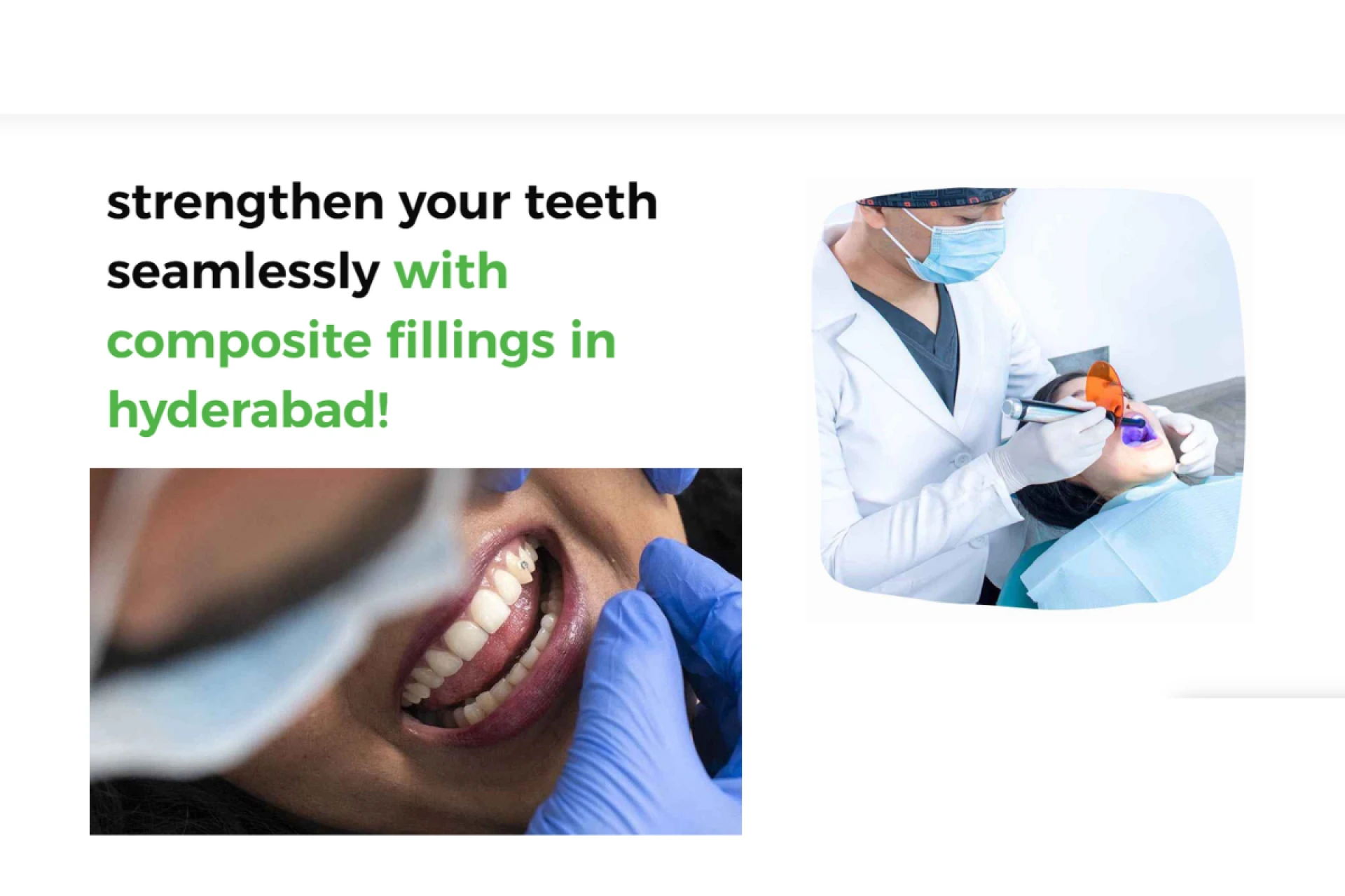 Strengthen Your Teeth Easily with Composite Fillings in Hyderabad