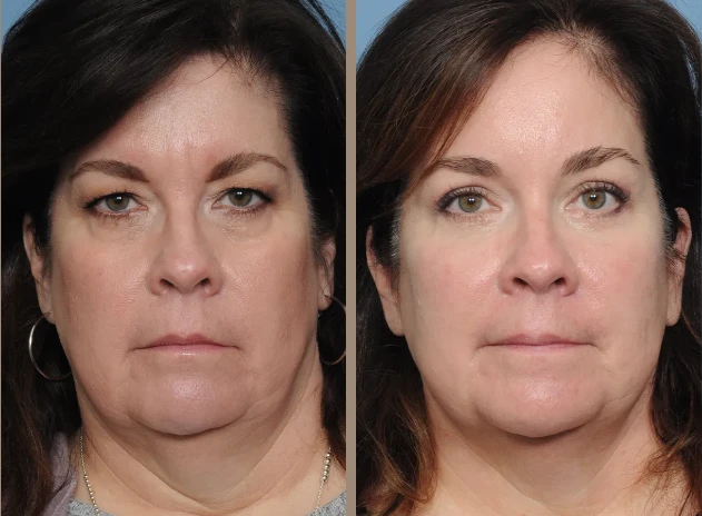 Your Natural Beauty with Expert Eyebrow Services in Austin, TX