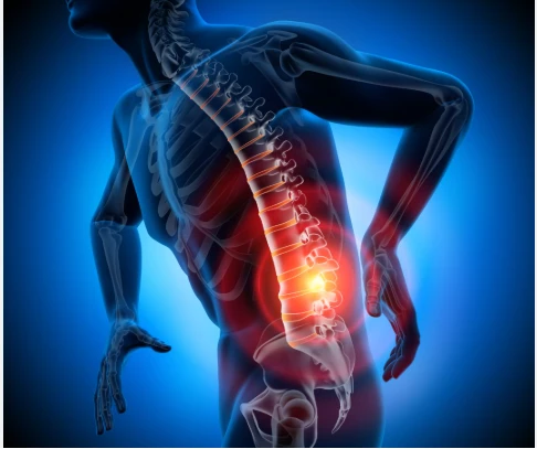 When Should I See a Nerve Specialist Doctor in Delhi for Sciatica Pain?