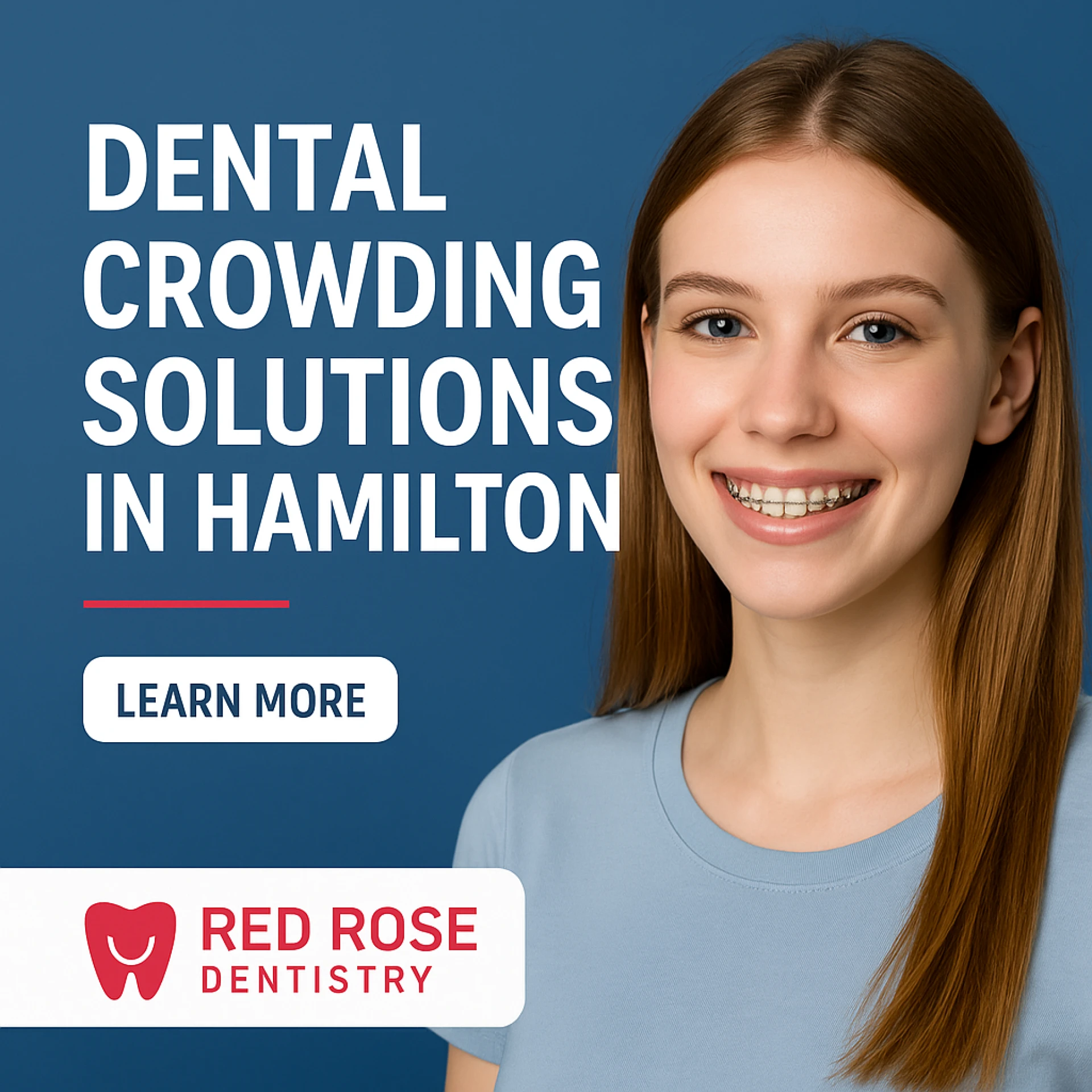 Dental Crowding Solutions in Hamilton — Red Rose Dentistry