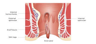 Prof. Dr. ASM Zahidur Rahman: Expert in Laparoscopic Surgery & Laser Proctology