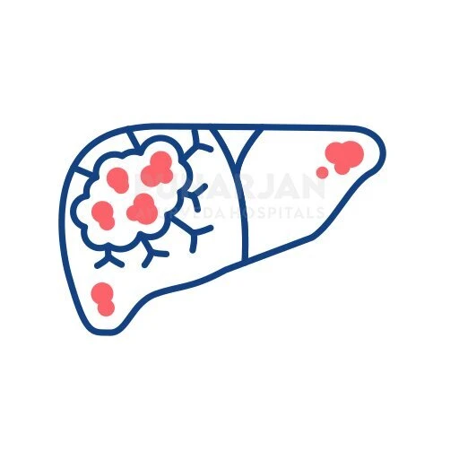 Liver Cancer - What are the Five Gospel Truths about the Disease