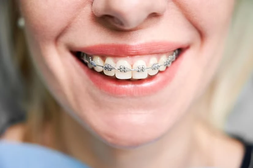 How to Choose the Best Orthodontic Specialist Near You